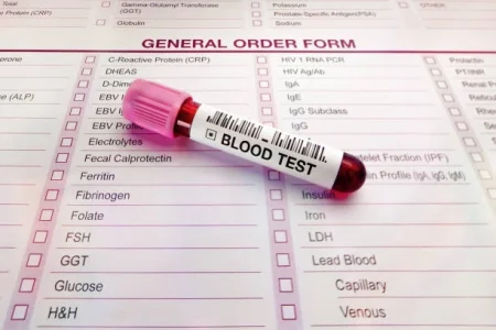 How to Check Lab Reports Online in Pakistan