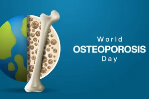 Bone Weakness Becoming a Public Health Threat in Pakistan Causes and Treatment